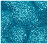 stem cells