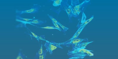 Harness the Power of Custom Polyclonal Antibodies to Uncover Novel Proteins