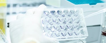 Cellular Immunity Evaluation