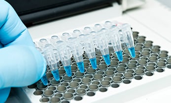 3. PCR-based DNA Synthesis (1980s)