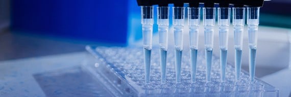 Optimizing Sensitivity in Antibody-Based Immunoassays: Key Strategies for Reliable Diagnostics