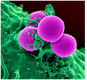 New class of antibiotic effective against MRSA