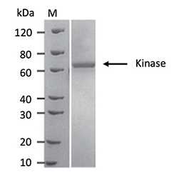 Sf9 cells express Kinase